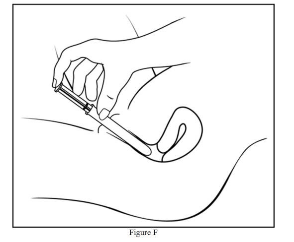 Step 5: Insert the pre-filled applicator (See Figure F)