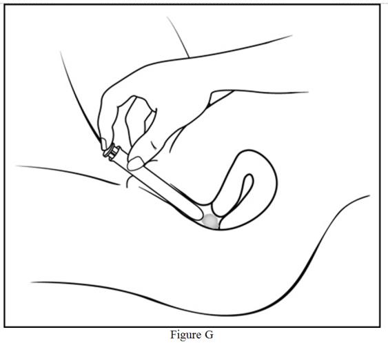 Step 6: Push the plunger (See Figure G) 