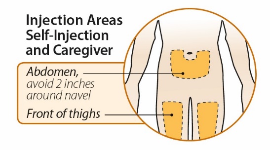 Autoinjector injections areas torso