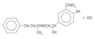 structural-formula-labetalol