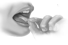 Step 3. Place on Tongue