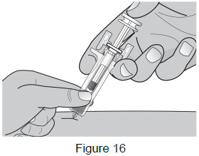 image of injection finger positioning - instructions for use